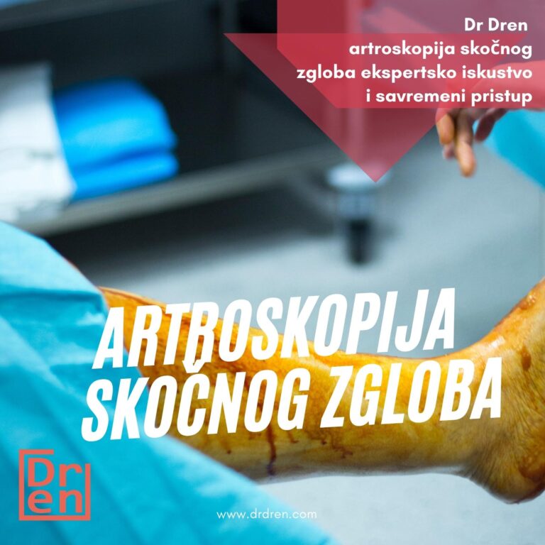 artroskopija skočnog zgloba