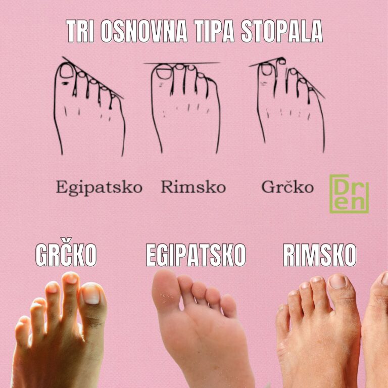 tipovi stopala koje je moje stopalo grčko rimsko egipatsko - Dr Dren tipovi stopala koje je moje stopalo grčko rimsko egipatsko