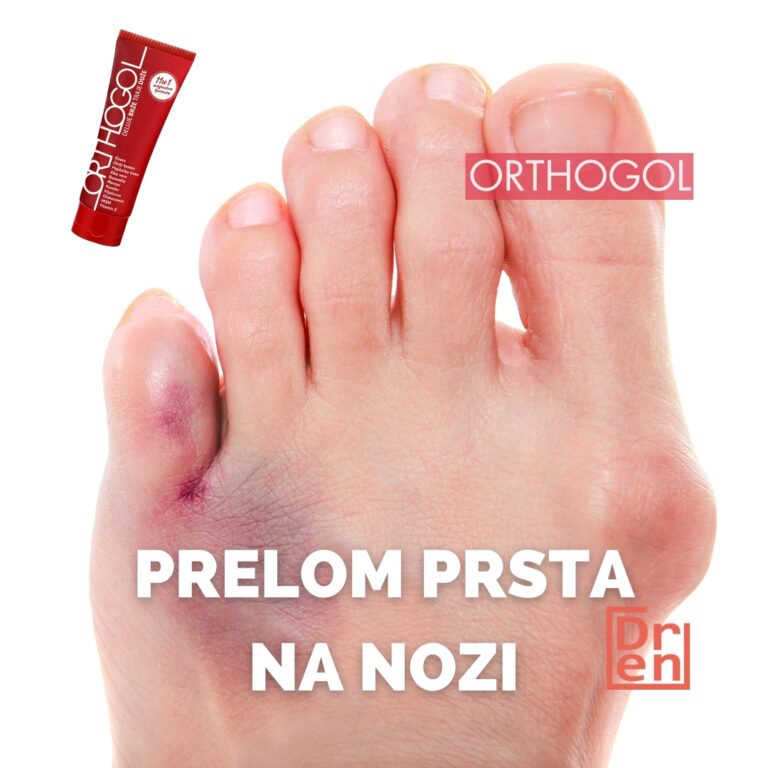 prelom prsta na nozi prelom nožnog prsta fraktura prsta stopala
